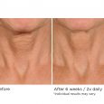 Deco-lift neck firming & lifting complex serum