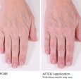 Hand Treatment Cream