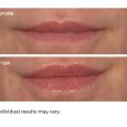 Hydro-screen for lips vanilla